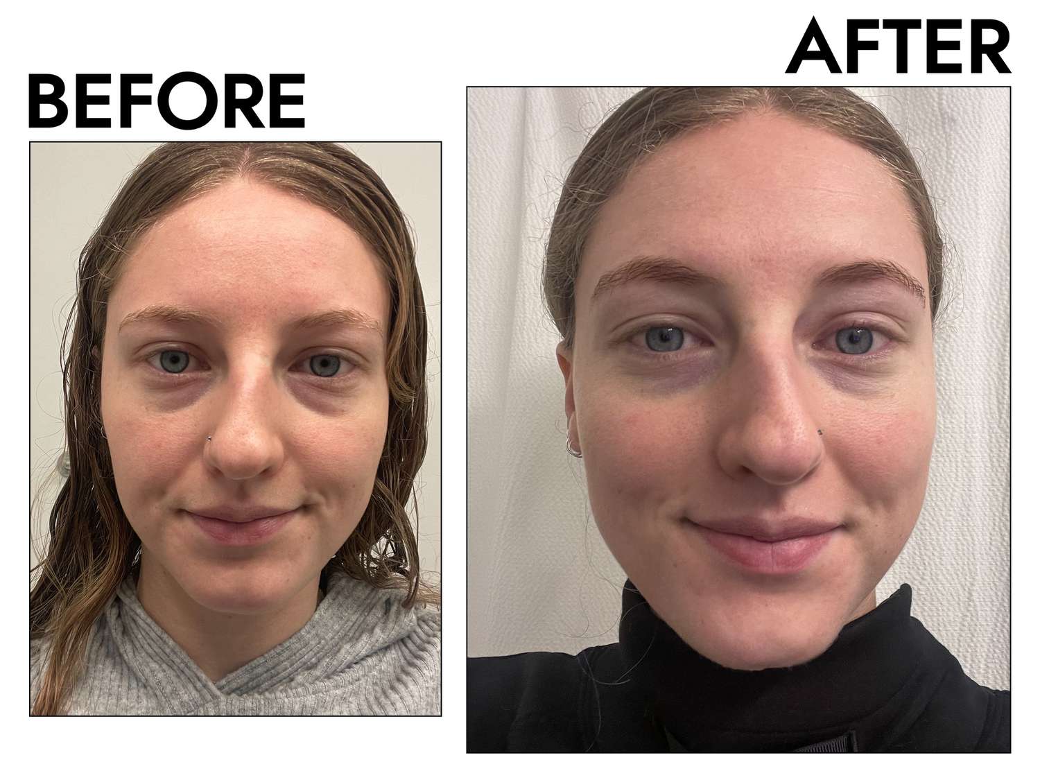 The 9 Best Face Washes for Dry Skin of 2025, According to Testers